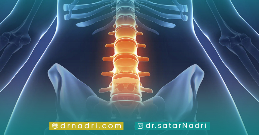 راه های پیشگیری از آرتروز ستون فقرات