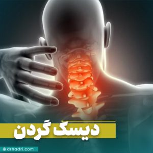 دیسک گردن چیست؟ علائم و روش‌ های درمان