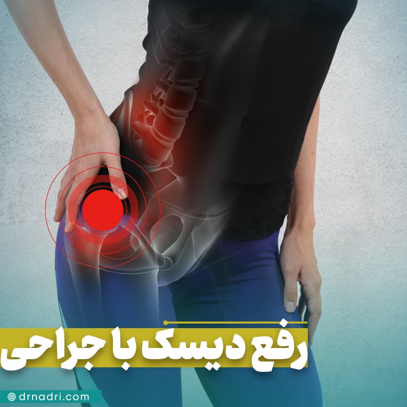 درمان قطعی دیسک کمر با جراحی