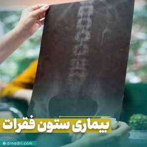 شایع ترین بیماری های ستون فقرات