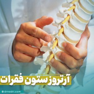 آرتروز ستون فقرات