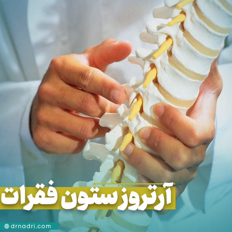 آرتروز ستون فقرات