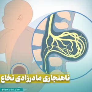 ناهنجاری‌ های مادرزادی شکاف در نخاع